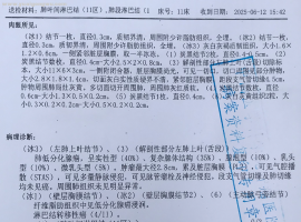 老公刚刚54岁，确诊肺癌，手术中发现转移，病理晚期