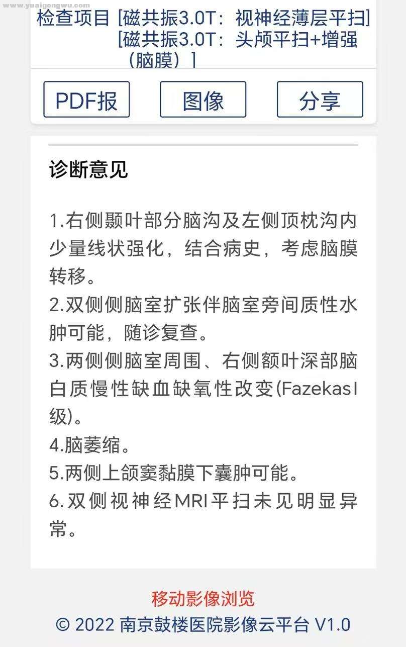 Weixin Image_2025-06-18_011745_857.jpg