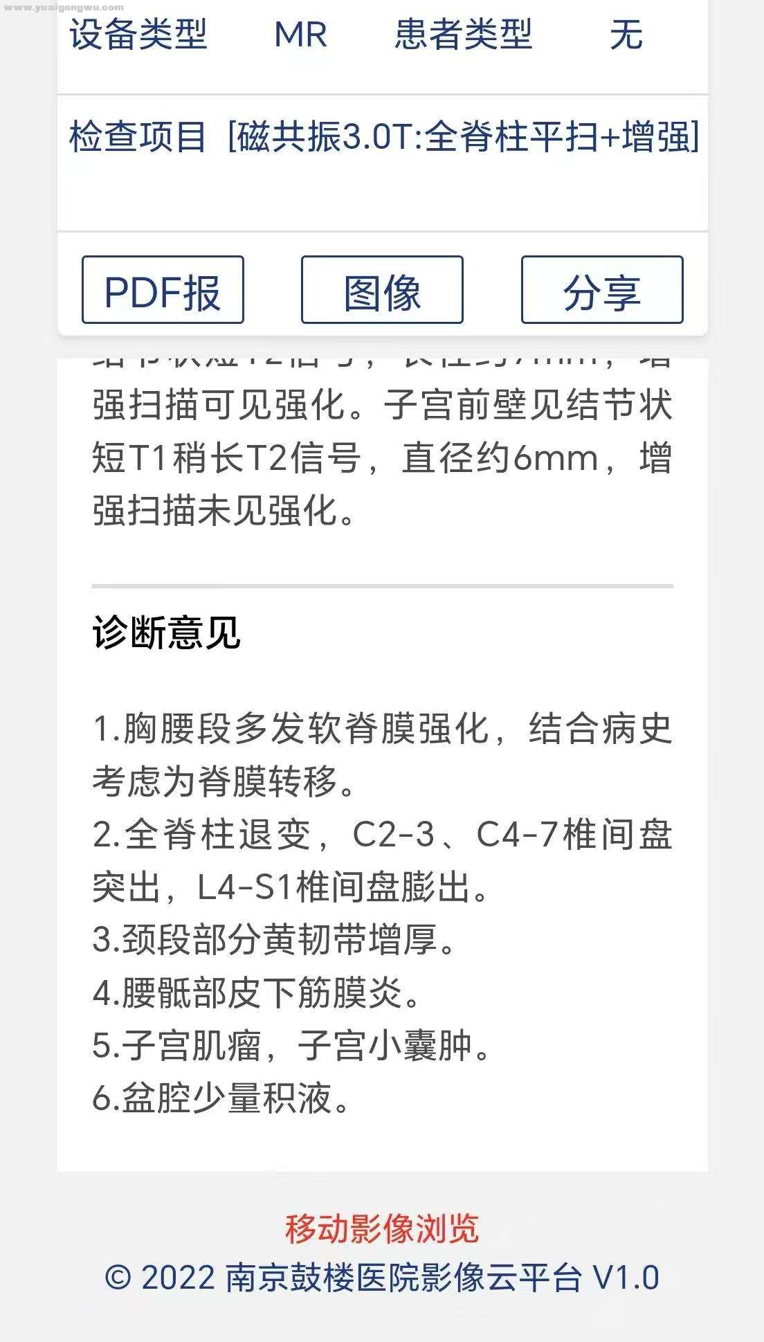 Weixin Image_2025-06-18_011756_240.jpg